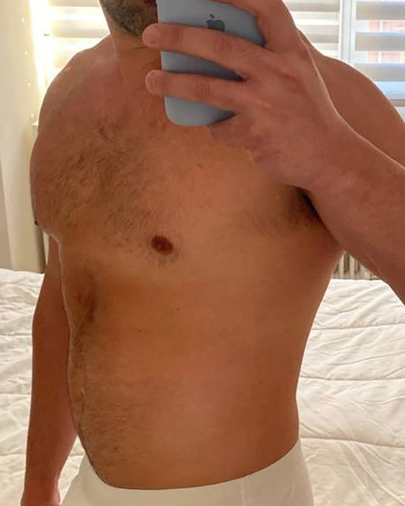 Caso 1: Antes de una transformación.